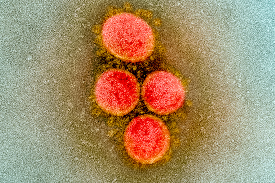 Transmission electron micrograph of SARS-CoV-2 virus particles, isolated from a patient. Image captured and color-enhanced at the NIAID Integrated Research Facility (IRF) in Fort Detrick, Maryland. Credit: NIAID