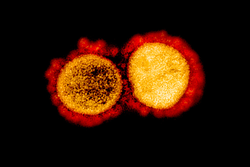 Transmission electron micrograph of SARS-CoV-2 virus particles, isolated from a patient. Image captured and color-enhanced at the NIAID Integrated Research Facility (IRF) in Fort Detrick, Maryland. Credit: NIAID