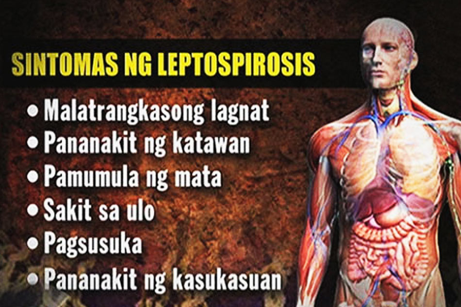 Leptospirosis Claims Life In Iloilo Abs Cbn News