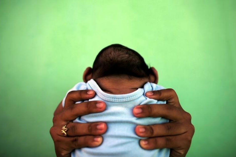 Two babies born with microcephaly in Iloilo 1