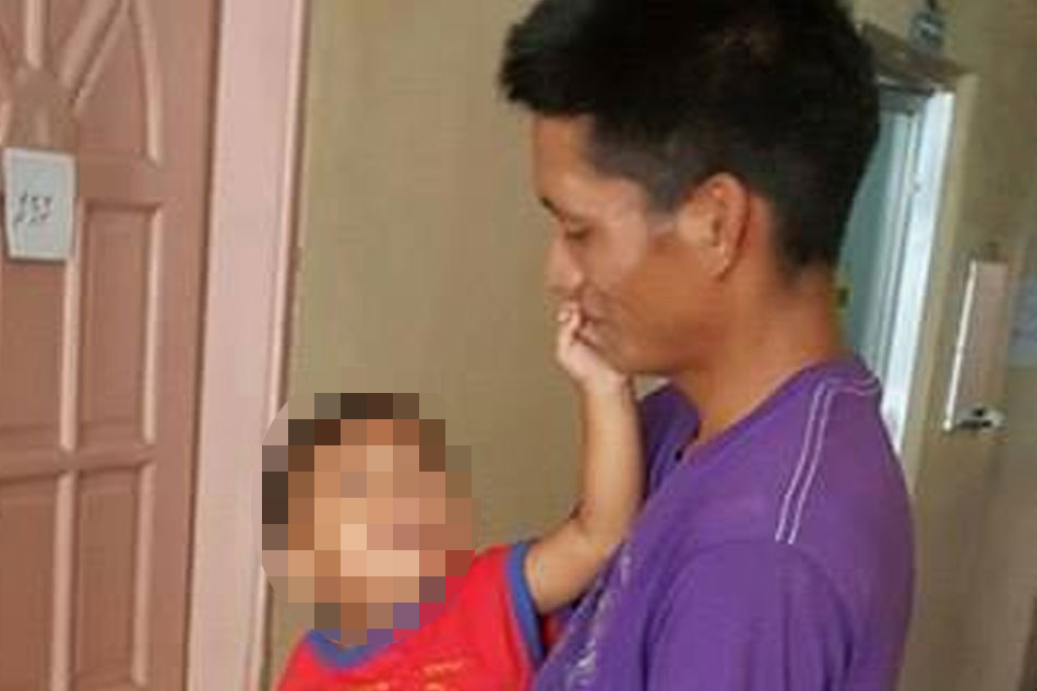 LOOK: Safety pin swallowed by 1-year-old boy 2
