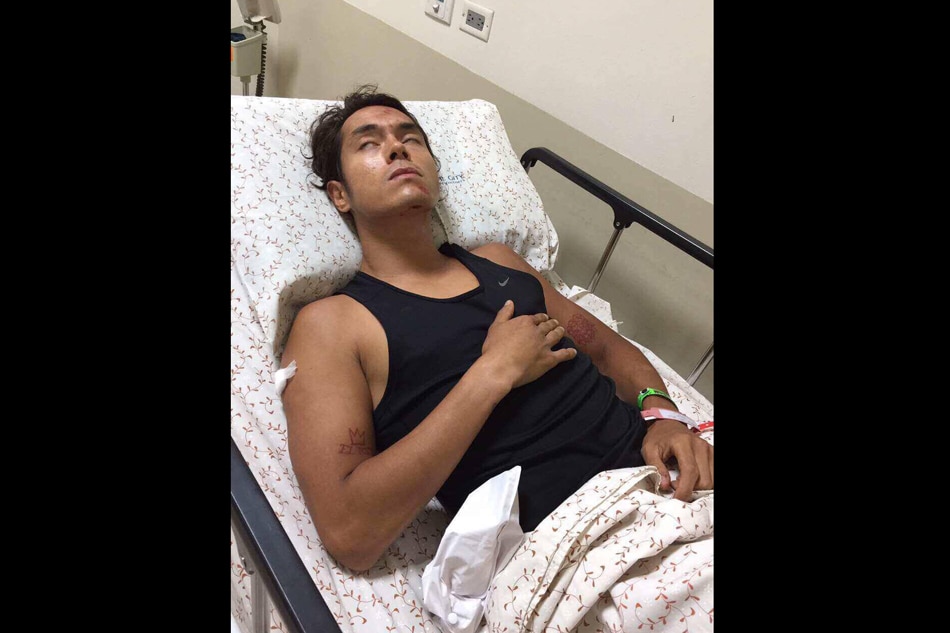 Jake Cuenca rushed to hospital after bike accident 1
