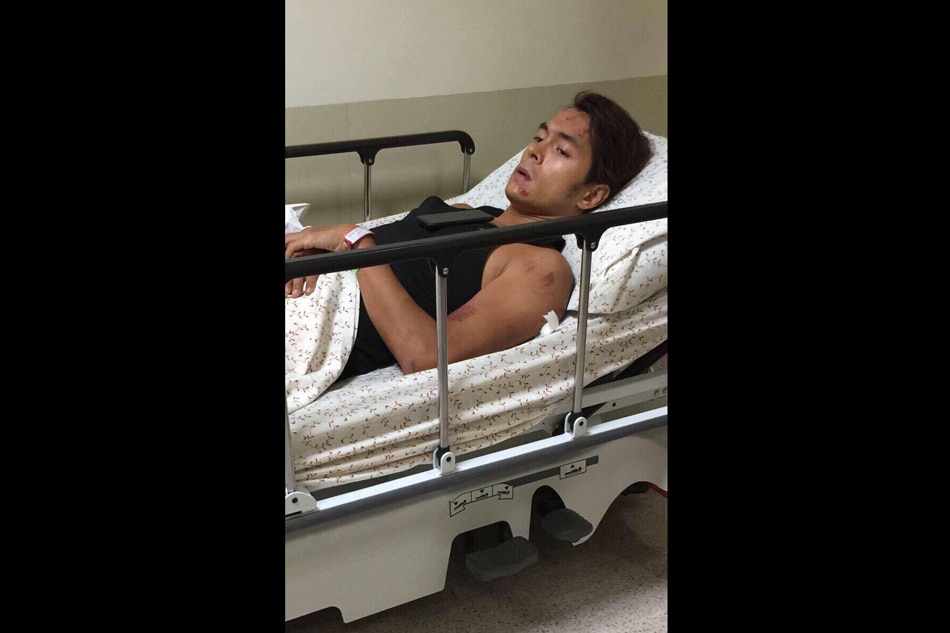 Jake Cuenca rushed to hospital after bike accident 3