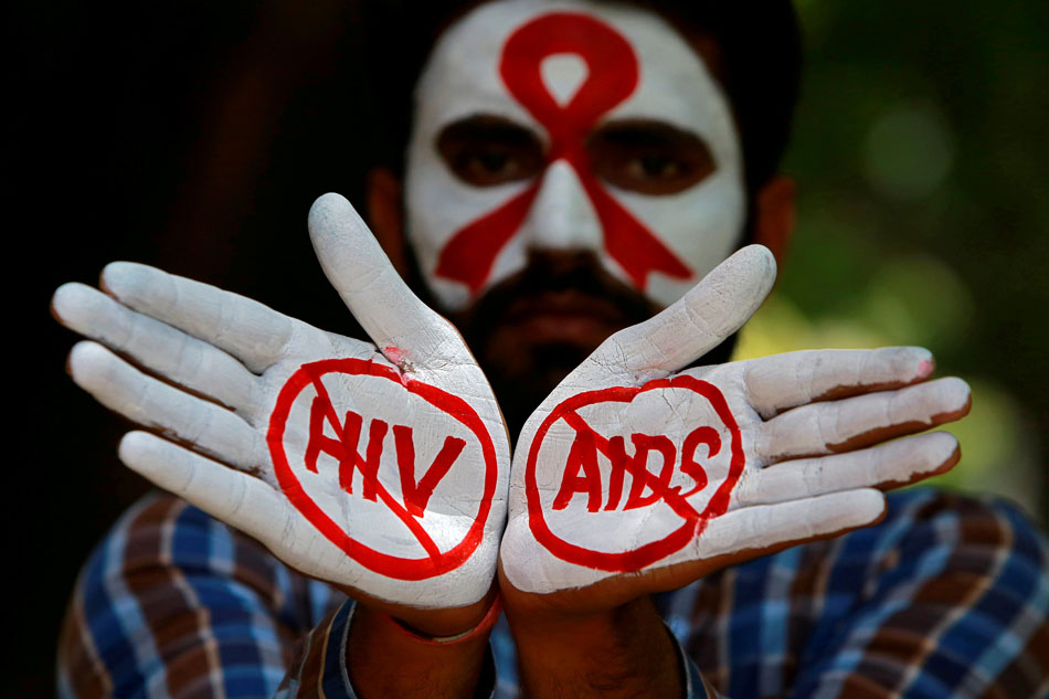 Men with same-sex partners 28 times more likely to get HIV- UN 1