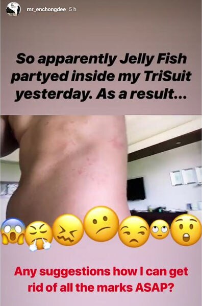 Enchong Dee stung by jellyfish during triathlon event 1