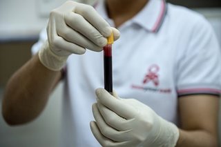 Latest biotechnology research on HIV may help build PH capacities against it: DOST
