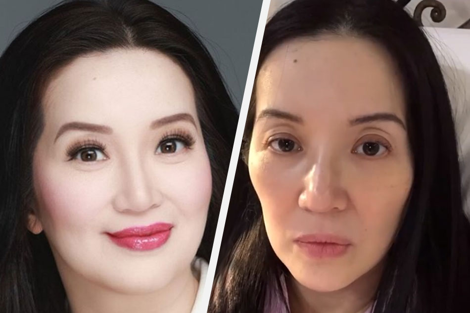 To Answer Fear Kris Aquino Undergoes Tumor Marker Tests Abs Cbn News