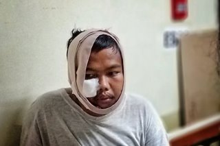 Quezon police, itinangging inarestong muli ang 'EJK survivor'
