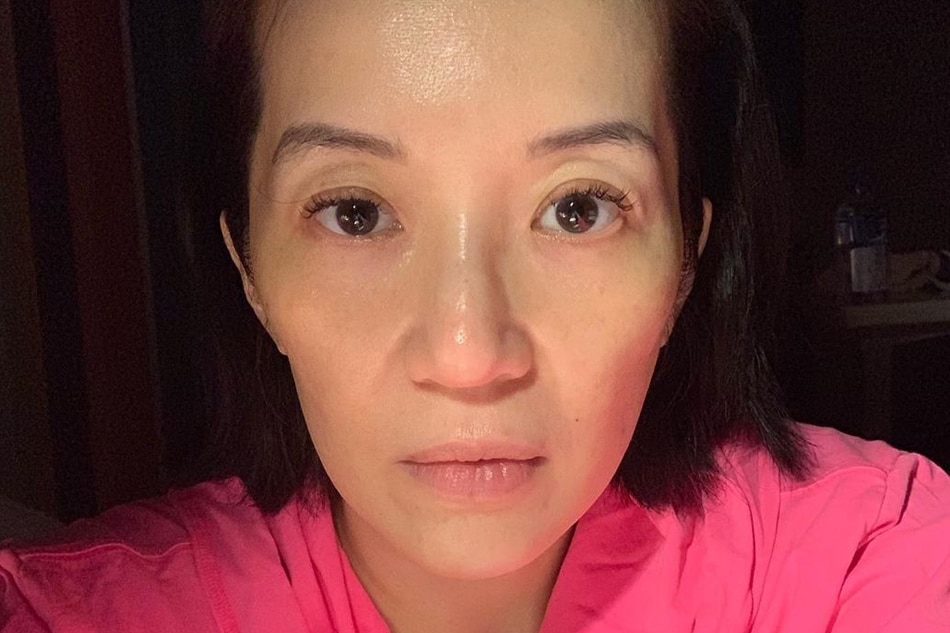 Look Kris Aquino Posts No Filter Selfie As She Asks For Tips To Fight Migraine Abs Cbn News