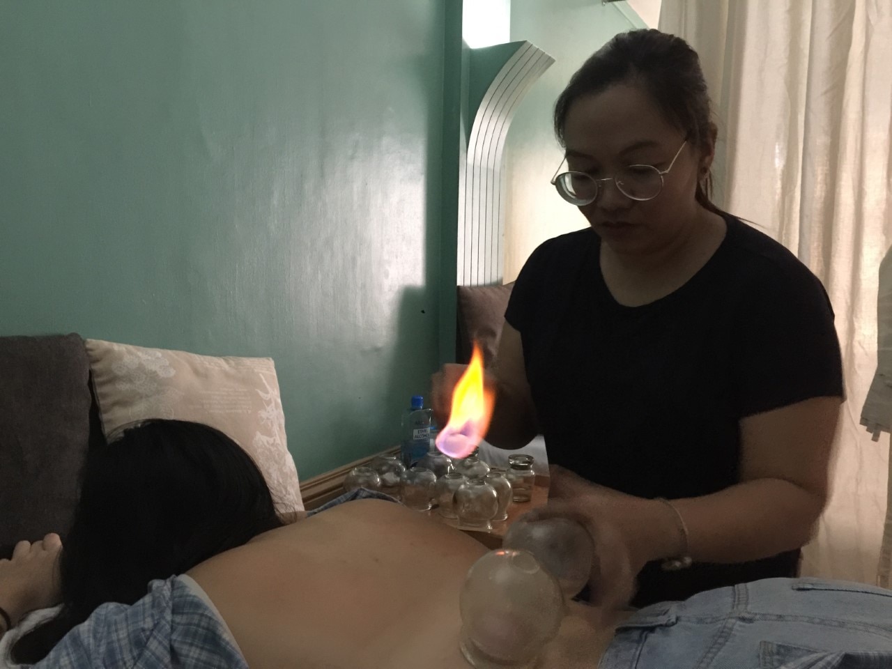 Fire and glass: What is ventosa or cupping therapy? 1