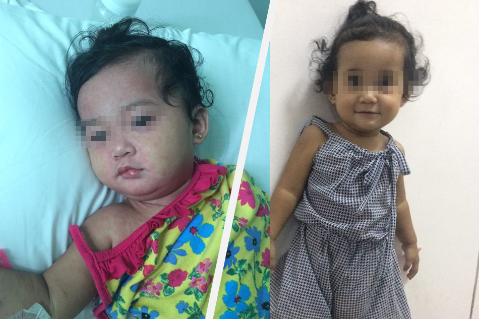 'Helpless, scared': Mom shares how daughter battled measles