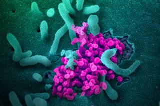 15 more overseas Filipinos catch coronavirus, total now at 9,725 - DFA