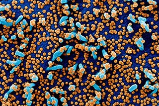 DFA: Filipinos abroad sick with coronavirus cross 9,000