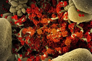 Tokyo reports 75 new coronavirus infections