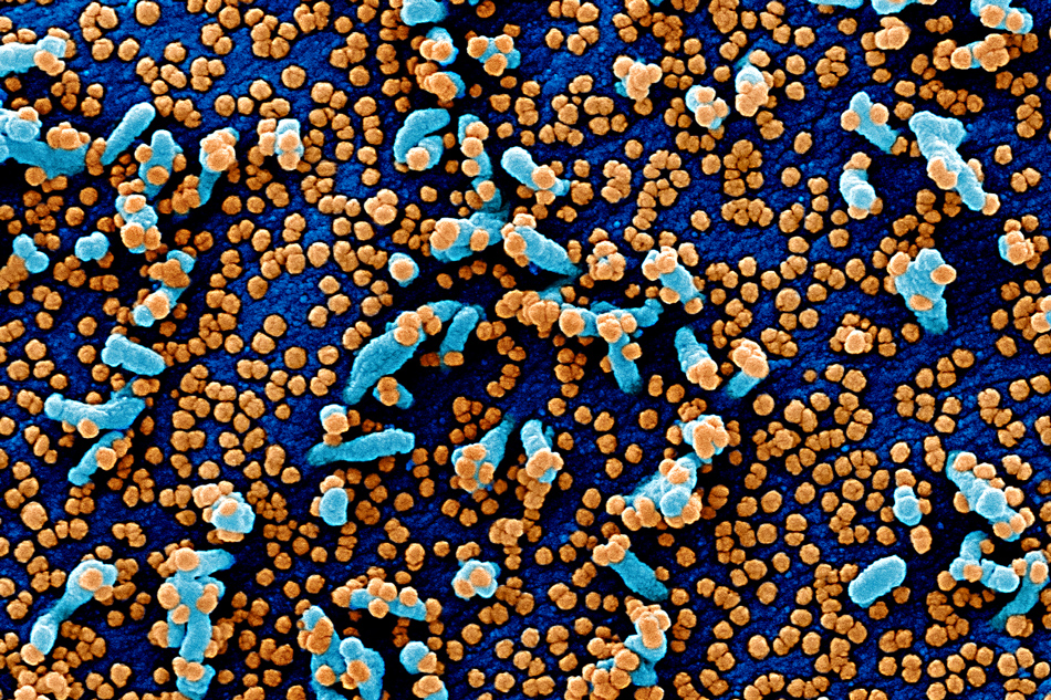 Number of overseas Filipinos with coronavirus tops 9,600 1
