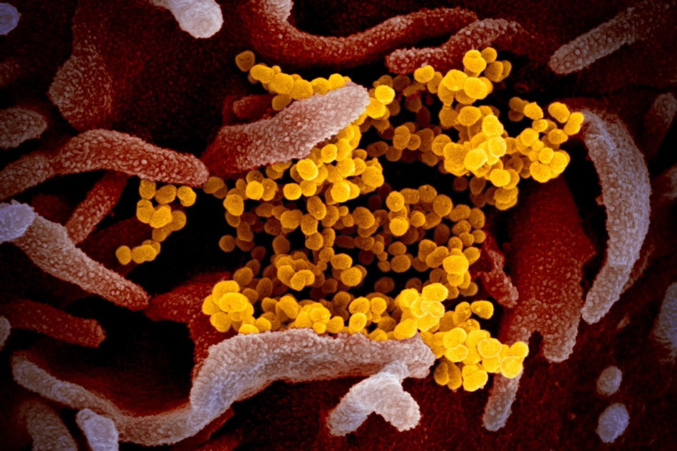 This scanning electron microscope image shows SARS-CoV-2 (yellow)—also known as 2019-nCoV, the virus that causes COVID-19—isolated from a patient in the U.S., emerging from the surface of cells (pink) cultured in the lab. Credit: NIAID-RML