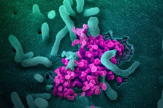 First PH patient with new COVID-19 variant recovers, to undergo monitoring
