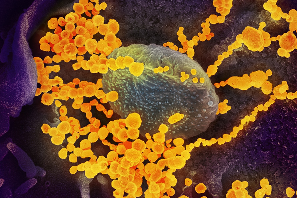 This scanning electron microscope image shows SARS-CoV-2 (round gold objects) emerging from the surface of cells cultured in the lab. SARS-CoV-2, also known as 2019-nCoV, is the virus that causes COVID-19. The virus shown was isolated from a patient in the US. NIAID-RML