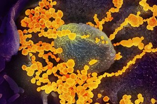 American study finds signs of coronavirus in US before China outbreak