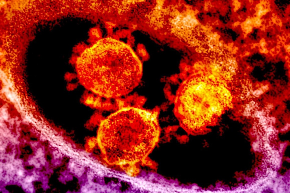 US announces approval of plasma treatment against virus 1