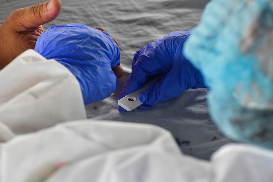 P422 million lost to overpriced coronavirus test kits: Drilon 1