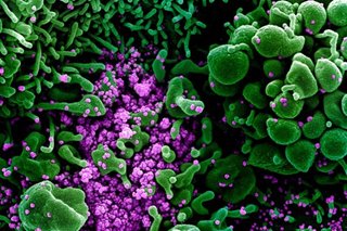 DFA: 25 more Filipinos abroad catch coronavirus; total now 10,385
