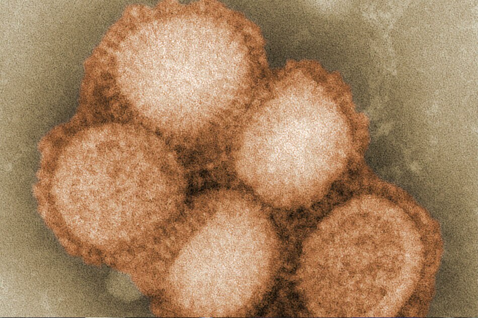 Rare strain of swine flu infects Canadian in Alberta 1