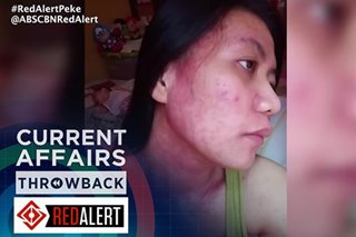 THROWBACK: Mag-ina, nabiktima ng pekeng beauty product