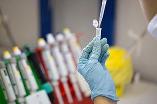 Russia produces first batch of virus vaccine, says ministry