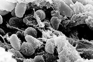 Man dies of bubonic plague in Mongolia