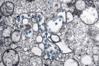 Regeneron plans early summer trials for new antibodies against coronavirus