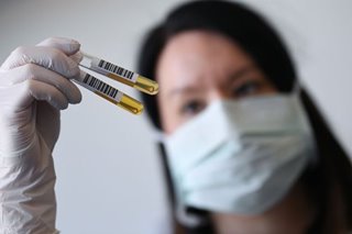 Improvement seen in COVID-19 patients given plasma transfusion: St Luke's doctors