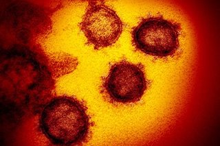 Philippines coronavirus cases surpass 34,000; recoveries cross 9,000