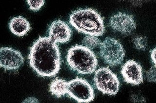 How the coronavirus short-circuits the immune system