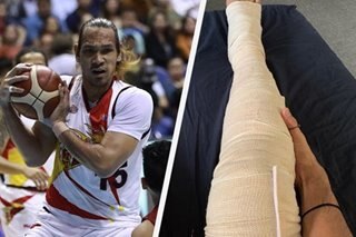 PBA: June Mar vows to hurdle ‘minor setback,’ as MVP deals with leg fracture
