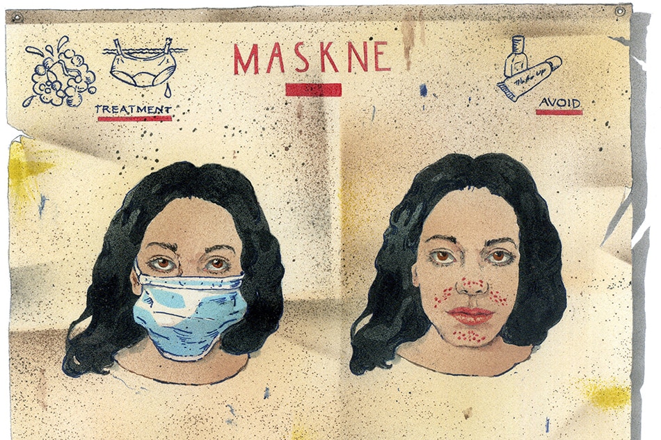 Maskne is the new acne, and here’s what is causing it 1