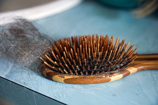 Hair loss can be another consequence of the COVID-19 pandemic