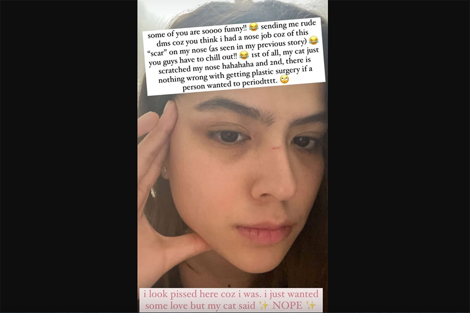 What nose job? ‘Nothing wrong,’ says Alexa Ilacad, but denies undergoing procedure 1