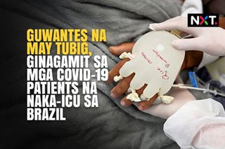 Guwantes na may tubig, ginagamit sa mga COVID-19 patients na naka-ICU sa Brazil