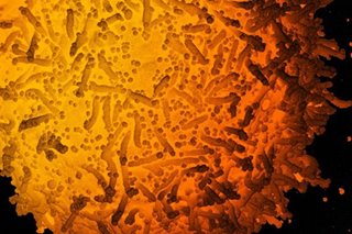 New York finds first case of more contagious, 'UK' strain of coronavirus