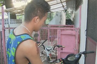 Lalaki sugatan matapos ma-hit-and-run sa Quezon City