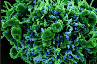Global coronavirus infection cases top 100 million