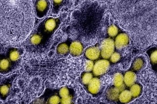 Brazilian, S.African virus strains found in Toronto