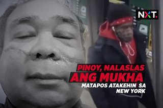 Pinoy, nalaslas ang mukha matapos atakehin sa New York