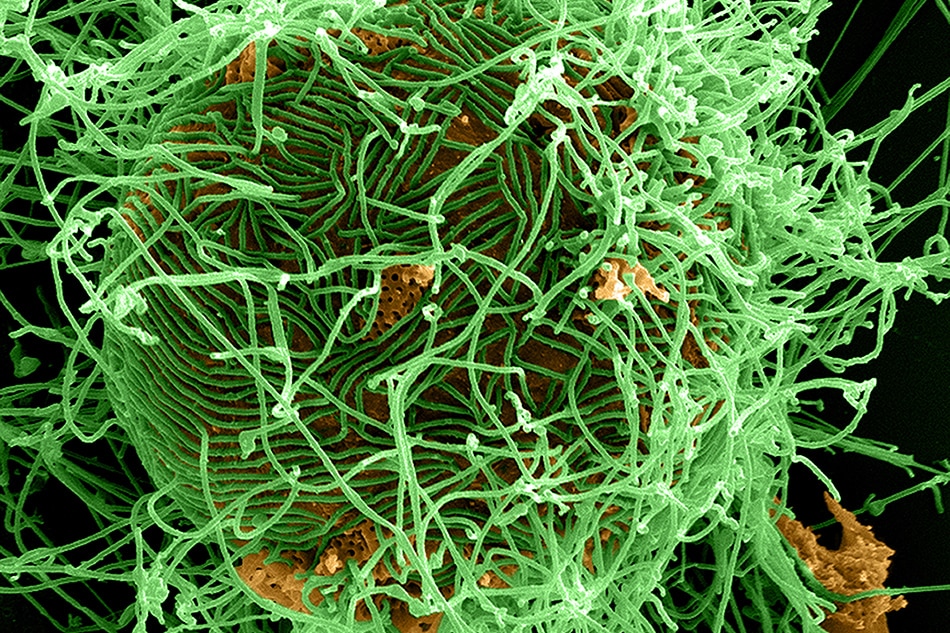 Ebola: profile of a prolific killer 1