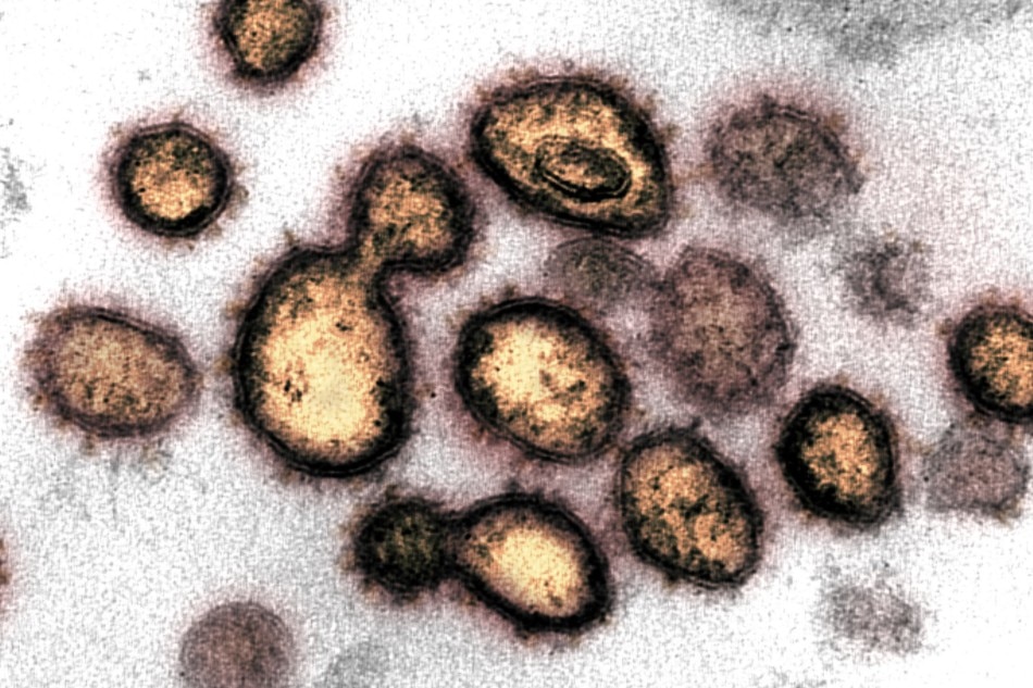 This transmission electron microscope image shows SARS-CoV-2, the virus that causes COVID-19, isolated from a patient in the U.S. Virus particles are shown emerging from the surface of cells cultured in the lab. The spikes on the outer edge of the virus particles give coronaviruses their name, crown-like. Image captured and colorized at NIAID's Rocky Mountain Laboratories (RML) in Hamilton, Montana. NIAID