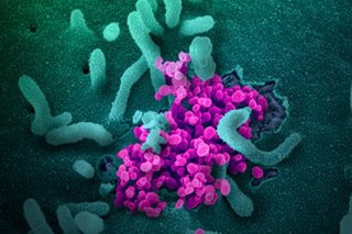Poor sleep history linked with more severe COVID-19