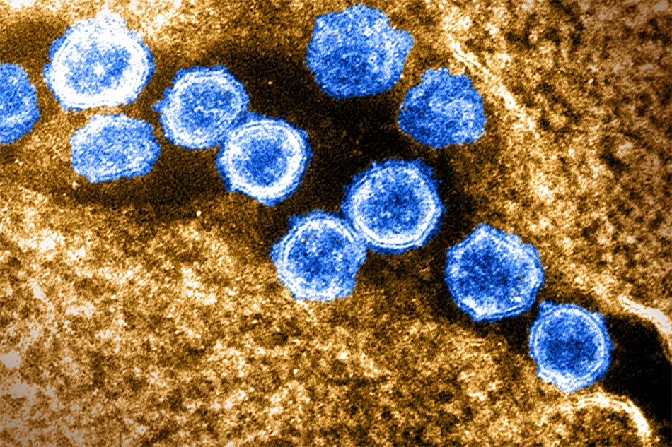 This transmission electron microscope image shows SARS-CoV-2, the virus that causes COVID-19. Virus particles are shown emerging from the surface of a cell cultured in the lab. The spikes on the outer edge of the virus particles give coronaviruses their name, crown-like. Image captured and colorized at Rocky Mountain Laboratories in Hamilton, Montana. Credit: NIAID