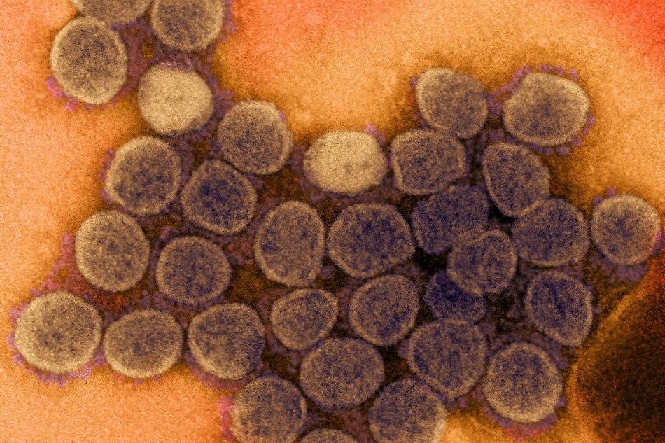 Transmission electron micrograph of a variant strain of SARS-CoV-2 virus particles (UK B.1.1.7), isolated from a patient sample and cultivated in cell culture. Image captured at the NIAID Integrated Research Facility (IRF) in Fort Detrick, Maryland. Credit: NIAID