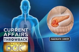 THROWBACK: Pancreatic cancer